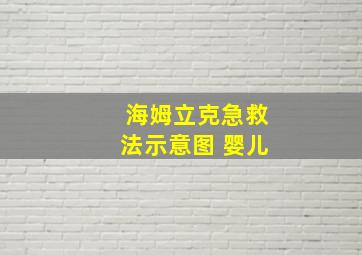 海姆立克急救法示意图 婴儿